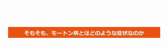 そもそも、「モートン病」とはどういう症状なのか